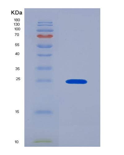 SDS-PAGE analysis of Human HSPB1 (Heat Shock Protein Beta-1) - Recombinant Protein, CAT# BLT-06597P, showing >85% purity under 15% SDS-PAGE (Reduced)Human HSPB1 (Heat Shock Protein Beta-1) - Recombinant Protein