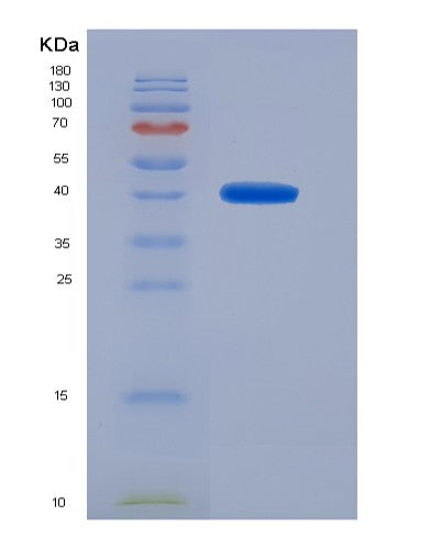 SDS-PAGE analysis of Human OGDH (2-Oxoglutarate Dehydrogenase Complex Component E1) - Recombinant Protein, CATHuman OGDH (2-Oxoglutarate Dehydrogenase Complex Component E1) - Recombinant Protein