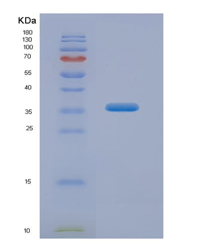 SDS-PAGE analysis of Human ARG1 (Arginase-1) - Recombinant Protein, CAT# BLT-04772P, showing >85% purity under 15% SDS-PAGE (Reduced)Human ARG1 (Arginase-1) - Recombinant Protein