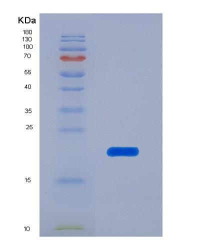SDS-PAGE analysis of Human HMGN1 (Non-Histone Chromosomal Protein Hmg-14) - Recombinant Protein, CATHuman HMGN1 (Non-Histone Chromosomal Protein Hmg-14) - Recombinant Protein