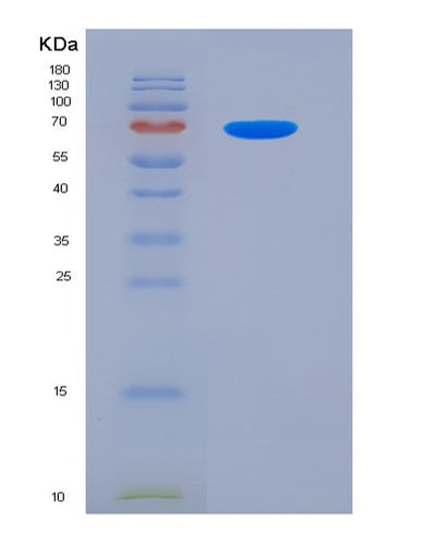 SDS-PAGE analysis of Human ALPL (Alkaline Phosphatase, Tissue-Nonspecific Isozyme) - Recombinant Protein, CAT# BLT-04170P, showing >90% purity under 15% SDS-PAGE (Reduced)Human ALPL (Alkaline Phosphatase, Tissue-Nonspecific Isozyme) - Recombinant Protein