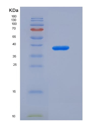 SDS-PAGE analysis of Human ALPL (Alkaline Phosphatase, Tissue-Nonspecific Isozyme) - Recombinant Protein, CAT# BLT-07502P, showing >90% purity under 15% SDS-PAGE (Reduced)Human ALPL (Alkaline Phosphatase, Tissue-Nonspecific Isozyme) - Recombinant Protein