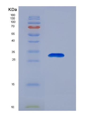 SDS-PAGE analysis of Human EIF2S1 (Eukaryotic Translation Initiation Factor 2 Subunit 1) - Recombinant Protein, CAT# BLT-00955P, showing >90% purity under 15% SDS-PAGE (Reduced)Human EIF2S1 (Eukaryotic Translation Initiation Factor 2 Subunit 1) - Recombinant Protein