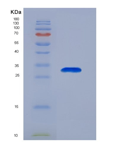 SDS-PAGE analysis of Human EIF2S1 (Eukaryotic Translation Initiation Factor 2 Subunit 1) - Recombinant Protein, CATHuman EIF2S1 (Eukaryotic Translation Initiation Factor 2 Subunit 1) - Recombinant Protein