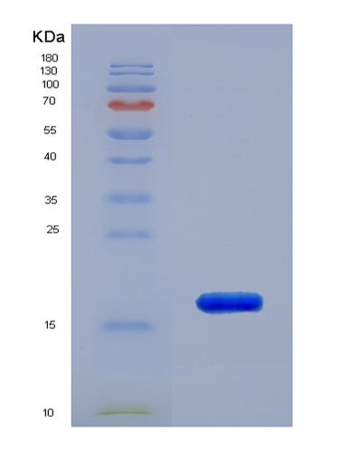 SDS-PAGE analysis of Human RPLP2 (Large Ribosomal Subunit Protein P2) - Recombinant Protein, CAT# BLT-02625P, showing >90% purity under 15% SDS-PAGE (Reduced)Human RPLP2 (Large Ribosomal Subunit Protein P2) - Recombinant Protein