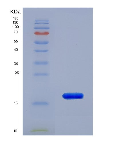 SDS-PAGE analysis of Human RPLP2 (Large Ribosomal Subunit Protein P2) - Recombinant Protein, CATHuman RPLP2 (Large Ribosomal Subunit Protein P2) - Recombinant Protein