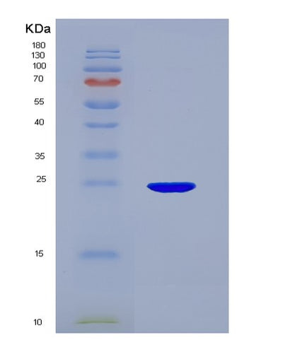 SDS-PAGE analysis of Human SCG5 (Neuroendocrine Protein 7B2) - Recombinant Protein, CAT# BLT-02704P, showing >85% purity under 15% SDS-PAGE (Reduced)Human SCG5 (Neuroendocrine Protein 7B2) - Recombinant Protein