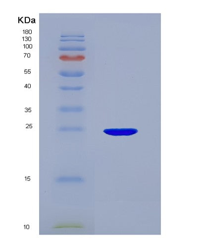 SDS-PAGE analysis of Human SCG5 (Neuroendocrine Protein 7B2) - Recombinant Protein, CATHuman SCG5 (Neuroendocrine Protein 7B2) - Recombinant Protein