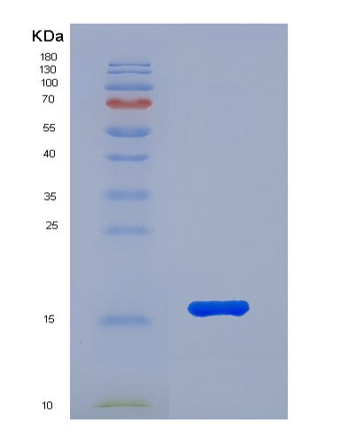 SDS-PAGE analysis of Human FABP3 (Fatty Acid-Binding Protein, Heart) - Recombinant Protein, CATHuman FABP3 (Fatty Acid-Binding Protein, Heart) - Recombinant Protein