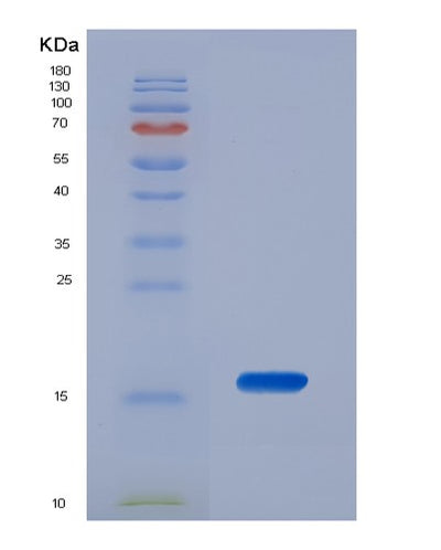 SDS-PAGE analysis of Human S100A6 (Protein S100-A6) - Recombinant Protein, CAT# BLT-06287P, showing >90% purity under 15% SDS-PAGE (Reduced)Human S100A6 (Protein S100-A6) - Recombinant Protein