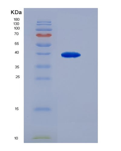 SDS-PAGE analysis of Human AGTR1 (Type-1 Angiotensin Ii Receptor) - Recombinant Protein, CAT# BLT-07506P, showing >90% purity under 15% SDS-PAGE (Reduced)Human AGTR1 (Type-1 Angiotensin Ii Receptor) - Recombinant Protein