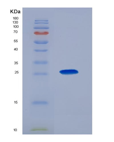 SDS-PAGE analysis of Human GP2 (Pancreatic Secretory Granule Membrane Major Glycoprotein Gp2) - Recombinant Protein, CAT# BLT-07507P, showing >90% purity under 15% SDS-PAGE (Reduced)Human GP2 (Pancreatic Secretory Granule Membrane Major Glycoprotein Gp2) - Recombinant Protein