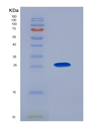 SDS-PAGE analysis of Human GP2 (Pancreatic Secretory Granule Membrane Major Glycoprotein Gp2) - Recombinant Protein, CATHuman GP2 (Pancreatic Secretory Granule Membrane Major Glycoprotein Gp2) - Recombinant Protein