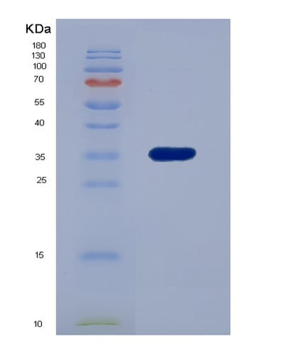 SDS-PAGE analysis of Human RCN2 (Reticulocalbin-2) - Recombinant Protein, CAT# BLT-07509P, showing >90% purity under 15% SDS-PAGE (Reduced)Human RCN2 (Reticulocalbin-2) - Recombinant Protein