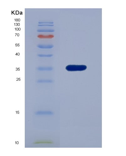 SDS-PAGE analysis of Human RCN2 (Reticulocalbin-2) - Recombinant Protein, CATHuman RCN2 (Reticulocalbin-2) - Recombinant Protein
