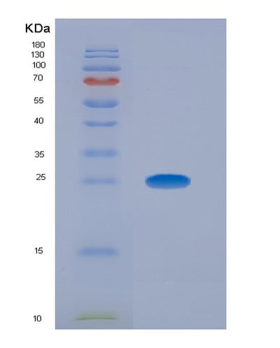 SDS-PAGE analysis of Human CEACAM8 (Cell Adhesion Molecule Ceacam8) - Recombinant Protein, CAT# BLT-07511P, showing >90% purity under 15% SDS-PAGE (Reduced)Human CEACAM8 (Cell Adhesion Molecule Ceacam8) - Recombinant Protein