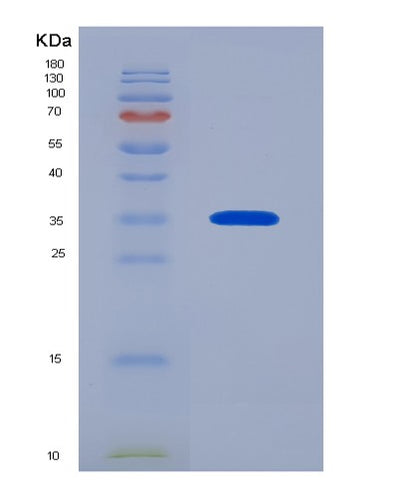 SDS-PAGE analysis of Human ASGR2 (Asialoglycoprotein Receptor 2) - Recombinant Protein, CAT# BLT-00237P, showing >85% purity under 15% SDS-PAGE (Reduced)Human ASGR2 (Asialoglycoprotein Receptor 2) - Recombinant Protein