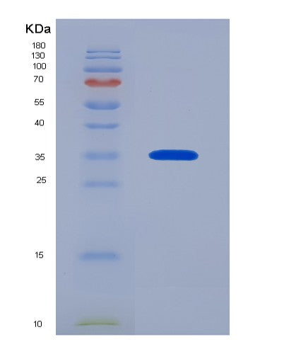 SDS-PAGE analysis of Human ASGR2 (Asialoglycoprotein Receptor 2) - Recombinant Protein, CATHuman ASGR2 (Asialoglycoprotein Receptor 2) - Recombinant Protein