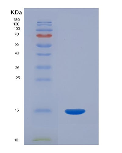 SDS-PAGE analysis of Human ACYP1 (Acylphosphatase-1) - Recombinant Protein, CAT# BLT-03478P, showing >95% purity under 15% SDS-PAGE (Reduced)Human ACYP1 (Acylphosphatase-1) - Recombinant Protein
