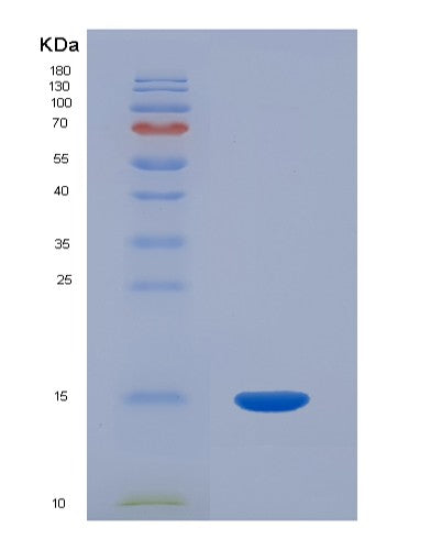 SDS-PAGE analysis of Human ACYP1 (Acylphosphatase-1) - Recombinant Protein, CATHuman ACYP1 (Acylphosphatase-1) - Recombinant Protein
