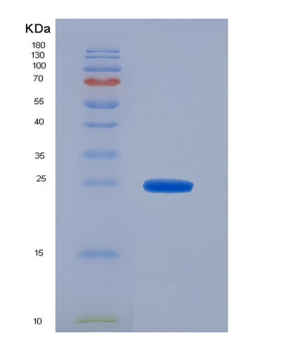 SDS-PAGE analysis of Human ADH1A (Alcohol Dehydrogenase 1A) - Recombinant Protein, CAT# BLT-00059P, showing >95% purity under 15% SDS-PAGE (Reduced)Human ADH1A (Alcohol Dehydrogenase 1A) - Recombinant Protein