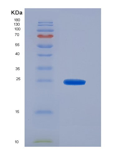 SDS-PAGE analysis of Human ADH1A (Alcohol Dehydrogenase 1A) - Recombinant Protein, CATHuman ADH1A (Alcohol Dehydrogenase 1A) - Recombinant Protein