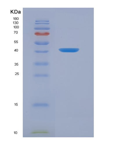 SDS-PAGE analysis of Human ANXA2 (Annexin A2) - Recombinant Protein, CAT# BLT-00160P, showing >95% purity under 15% SDS-PAGE (Reduced)Human ANXA2 (Annexin A2) - Recombinant Protein