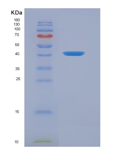 SDS-PAGE analysis of Human ANXA2 (Annexin A2) - Recombinant Protein, CATHuman ANXA2 (Annexin A2) - Recombinant Protein