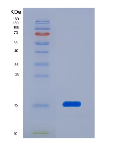 SDS-PAGE analysis of Human PFN1 (Profilin-1) - Recombinant Protein, CAT# BLT-02386P, showing >95% purity under 15% SDS-PAGE (Reduced)Human PFN1 (Profilin-1) - Recombinant Protein