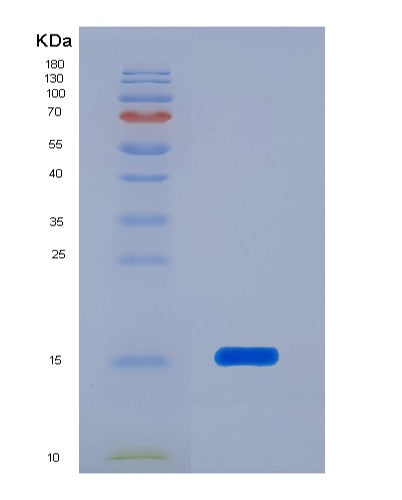 SDS-PAGE analysis of Human PFN1 (Profilin-1) - Recombinant Protein, CATHuman PFN1 (Profilin-1) - Recombinant Protein