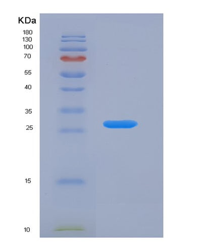 SDS-PAGE analysis of Human BPGM (Bisphosphoglycerate Mutase) - Recombinant Protein, CAT# BLT-00348P, showing >85% purity under 15% SDS-PAGE (Reduced)Human BPGM (Bisphosphoglycerate Mutase) - Recombinant Protein