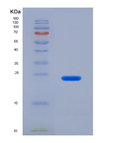 SDS-PAGE analysis of Human APRT (Adenine Phosphoribosyltransferase) - Recombinant Protein, CAT# BLT-00194P, showing >90% purity under 15% SDS-PAGE (Reduced)Human APRT (Adenine Phosphoribosyltransferase) - Recombinant Protein