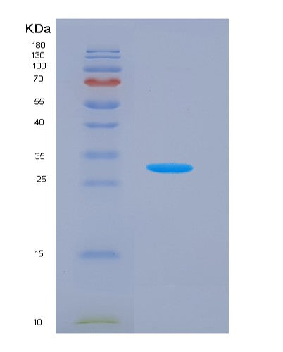 SDS-PAGE analysis of Human LYN (Tyrosine-Protein Kinase Lyn) - Recombinant Protein, CATHuman LYN (Tyrosine-Protein Kinase Lyn) - Recombinant Protein