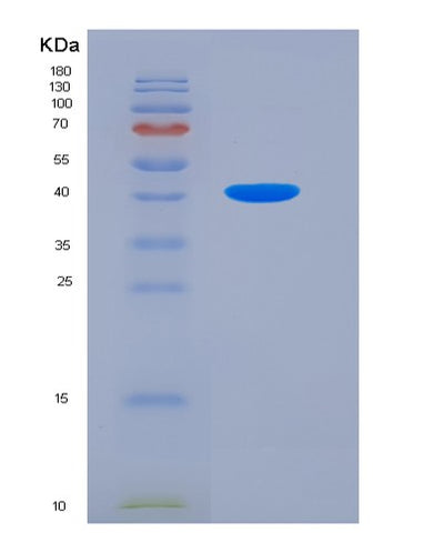 SDS-PAGE analysis of Human TPM2 (Tropomyosin Beta Chain) - Recombinant Protein, CAT# BLT-03109P, showing >90% purity under 15% SDS-PAGE (Reduced)Human TPM2 (Tropomyosin Beta Chain) - Recombinant Protein