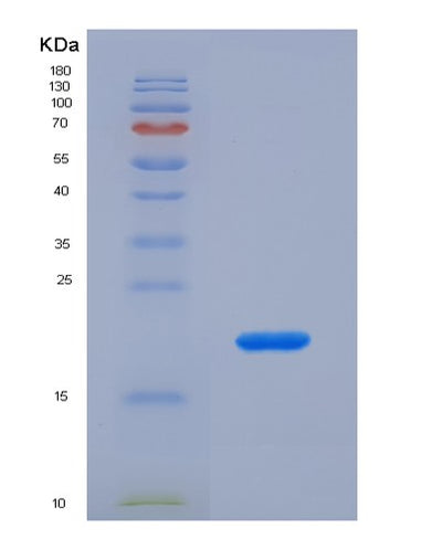 SDS-PAGE analysis of Human FH (Fumarate Hydratase, Mitochondrial) - Recombinant Protein, CAT# BLT-04901P, showing >85% purity under 15% SDS-PAGE (Reduced)Human FH (Fumarate Hydratase, Mitochondrial) - Recombinant Protein