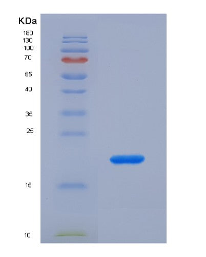 SDS-PAGE analysis of Human FH (Fumarate Hydratase, Mitochondrial) - Recombinant Protein, CATHuman FH (Fumarate Hydratase, Mitochondrial) - Recombinant Protein