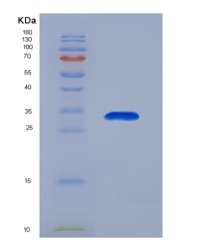 SDS-PAGE analysis of Human ANXA6 (Annexin A6) - Recombinant Protein, CATHuman ANXA6 (Annexin A6) - Recombinant Protein