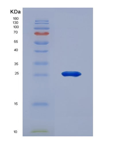 SDS-PAGE analysis of Human MMP2 (72 Kda Type Iv Collagenase) - Recombinant Protein, CAT# BLT-01875P, showing >95% purity under 15% SDS-PAGE (Reduced)Human MMP2 (72 Kda Type Iv Collagenase) - Recombinant Protein