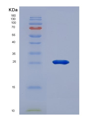 SDS-PAGE analysis of Human MMP2 (72 Kda Type Iv Collagenase) - Recombinant Protein, CATHuman MMP2 (72 Kda Type Iv Collagenase) - Recombinant Protein