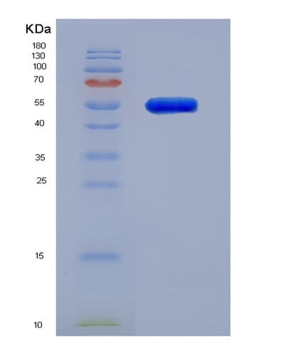 SDS-PAGE analysis of Human MMP3 (Stromelysin-1) - Recombinant Protein, CAT# BLT-01878P, showing >95% purity under 15% SDS-PAGE (Reduced)Human MMP3 (Stromelysin-1) - Recombinant Protein
