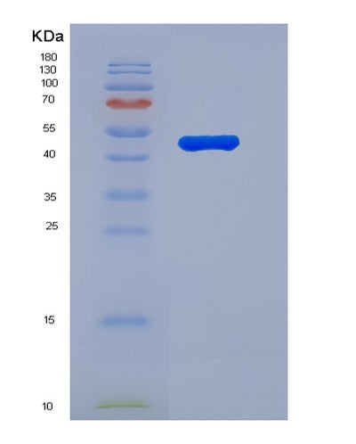 SDS-PAGE analysis of Human NPR3 (Atrial Natriuretic Peptide Receptor 3) - Recombinant Protein, CAT# BLT-07512P, showing >90% purity under 15% SDS-PAGE (Reduced)Human NPR3 (Atrial Natriuretic Peptide Receptor 3) - Recombinant Protein