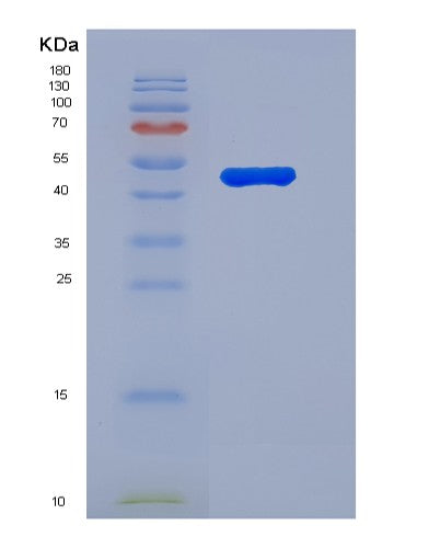 SDS-PAGE analysis of Human NPR3 (Atrial Natriuretic Peptide Receptor 3) - Recombinant Protein, CATHuman NPR3 (Atrial Natriuretic Peptide Receptor 3) - Recombinant Protein