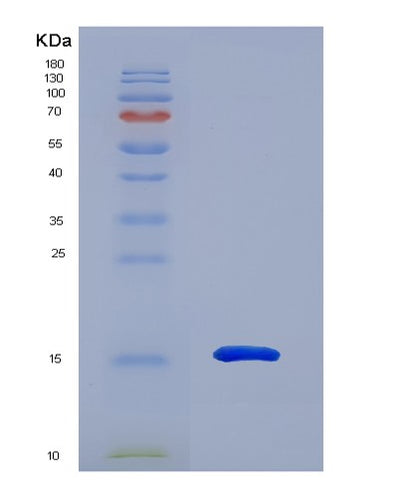 SDS-PAGE analysis of Human MGP (Matrix Gla Protein) - Recombinant Protein, CAT# BLT-01849P, showing >90% purity under 15% SDS-PAGE (Reduced)Human MGP (Matrix Gla Protein) - Recombinant Protein