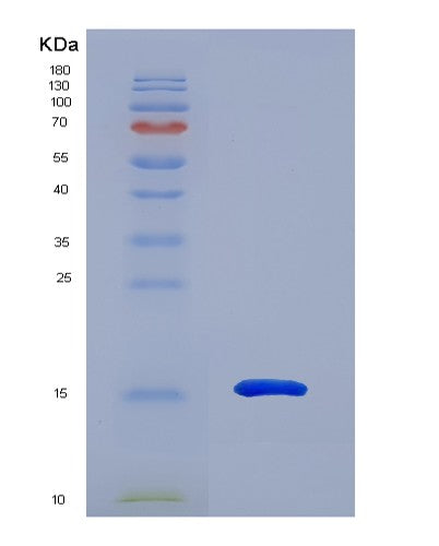 SDS-PAGE analysis of Human MGP (Matrix Gla Protein) - Recombinant Protein, CATHuman MGP (Matrix Gla Protein) - Recombinant Protein