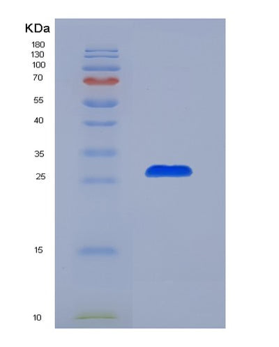 SDS-PAGE analysis of Mouse Il6 (Interleukin-6) - Recombinant Protein, CAT# BLT-01550P, showing >85% purity under 15% SDS-PAGE (Reduced)Mouse Il6 (Interleukin-6) - Recombinant Protein