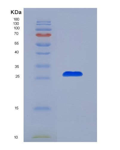 SDS-PAGE analysis of Mouse Il6 (Interleukin-6) - Recombinant Protein, CATMouse Il6 (Interleukin-6) - Recombinant Protein
