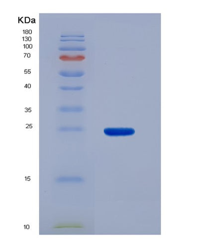 SDS-PAGE analysis of Human SDHB (Succinate Dehydrogenase [Ubiquinone] Iron-Sulfur Subunit, Mitochondrial) - Recombinant Protein, CAT# BLT-07514P, showing >90% purity under 15% SDS-PAGE (Reduced)Human SDHB (Succinate Dehydrogenase [Ubiquinone] Iron-Sulfur Subunit, Mitochondrial) - Recombinant Protein