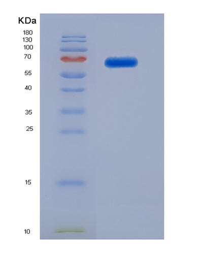 SDS-PAGE analysis of Human VTN (Vitronectin) - Recombinant Protein, CAT# BLT-07518P, showing >90% purity under 15% SDS-PAGE (Reduced)Human VTN (Vitronectin) - Recombinant Protein