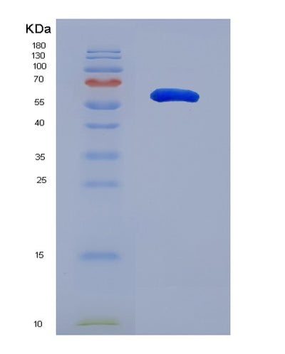 SDS-PAGE analysis of Human SLC26A7 (Anion Exchange Transporter) - Recombinant Protein, CAT# BLT-07520P, showing >90% purity under 15% SDS-PAGE (Reduced)Human SLC26A7 (Anion Exchange Transporter) - Recombinant Protein
