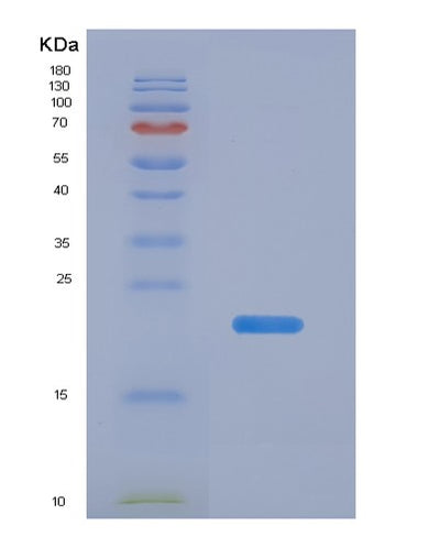 SDS-PAGE analysis of Mouse Nos2 (Nitric Oxide Synthase, Inducible) - Recombinant Protein, CAT# BLT-07522P, showing >90% purity under 15% SDS-PAGE (Reduced)Mouse Nos2 (Nitric Oxide Synthase, Inducible) - Recombinant Protein